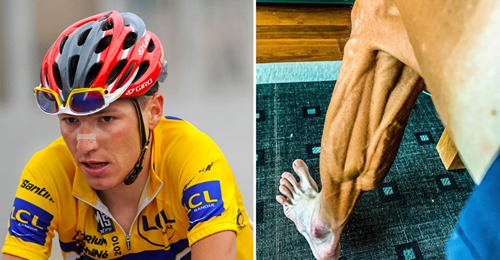 Ciclista publica foto chocante dos seus músculos da perna depois de uma corrida