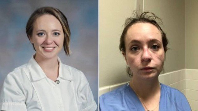 Enfermeira mostra o antes e o depois de 7 meses na linha da frente contra a COVID-19