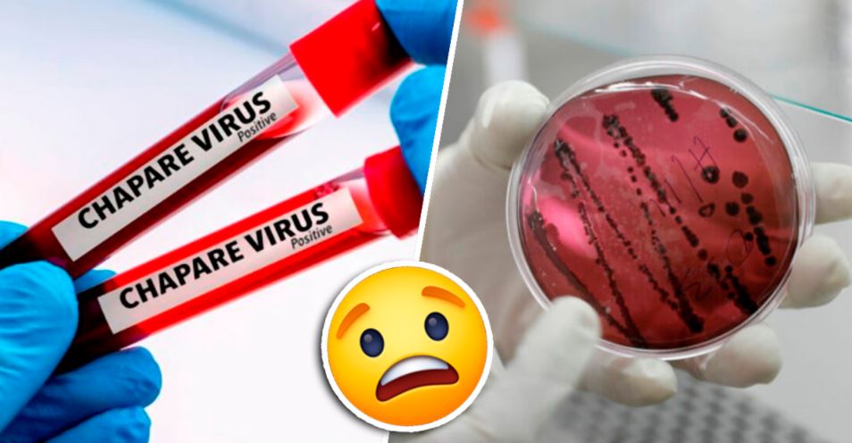 Descobriram um vírus na Bolívia que é similar ao ébola...