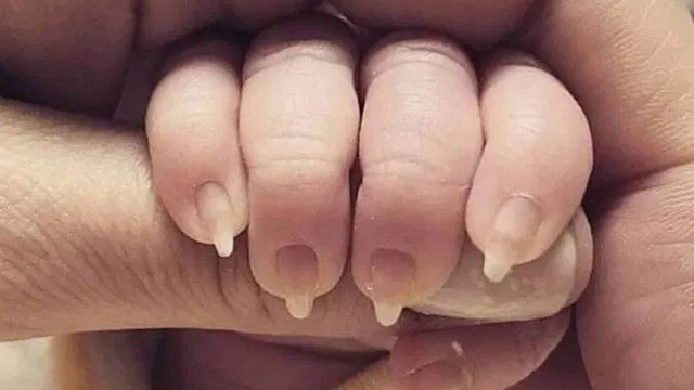 Mulher gera revolta nas redes sociais depois de ter feito as unhas à sua bebé
