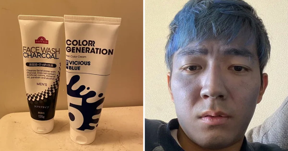 A cara deste homem ficou azul depois de ele ter usado um produto para pintar o cabelo, que confundiu com creme da cara