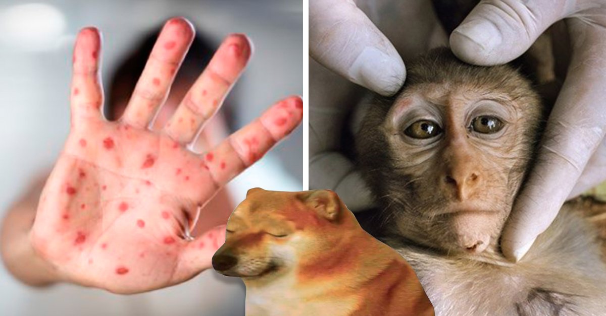 Foi detetado o primeiro caso da varíola dos macacos