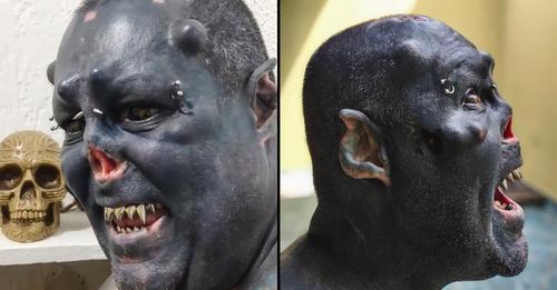 Homem que removeu o nariz para se parecer com um ogre mostra como era antes de todas as modificações corporais