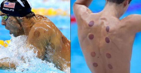 Eis a razão pela qual os nadadores olímpicos têm círculos escuros no seu corpo