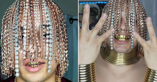 Rapper faz cirurgia para implantar correntes de ouro na cabeça a fazer de cabelo